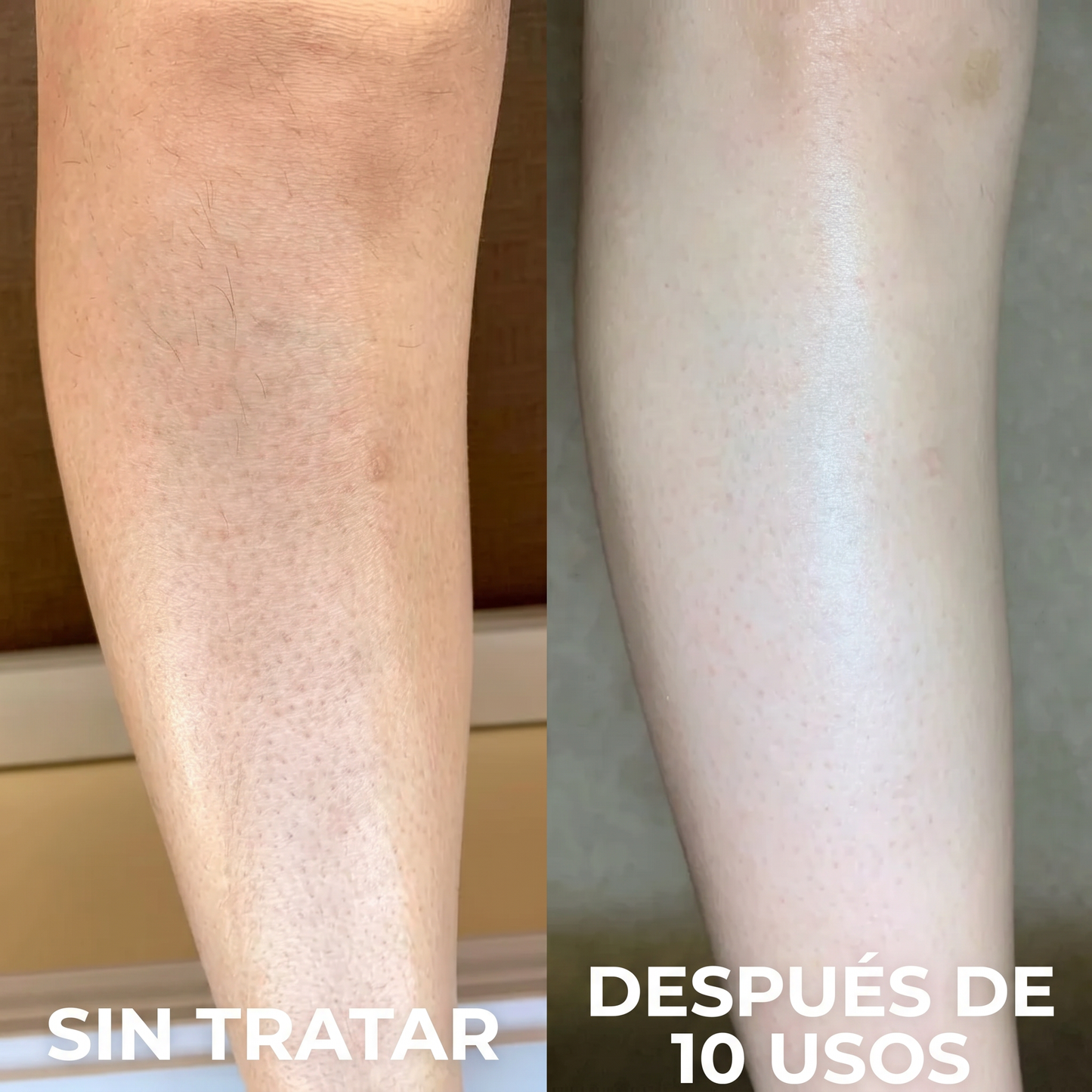 Uve Skin | Borra Granitos & Manchas Corporal